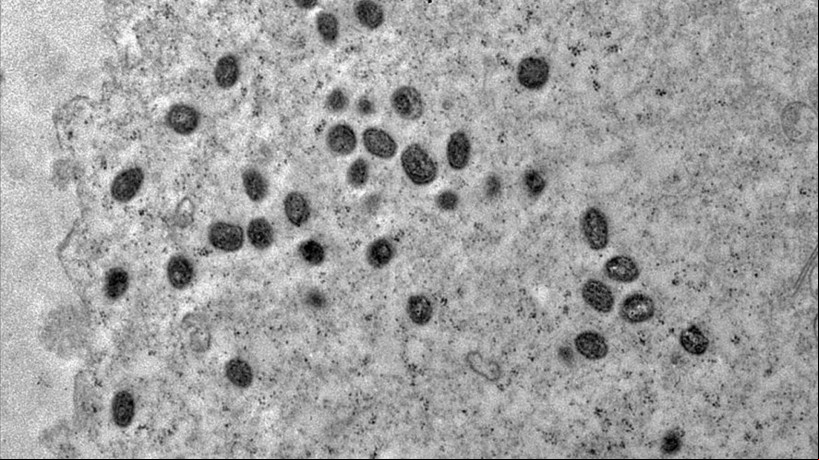 Em novembro, a OMS anunciou a troca do nome "varíola do macaco", "monkeypox" em inglês, por "mpox"