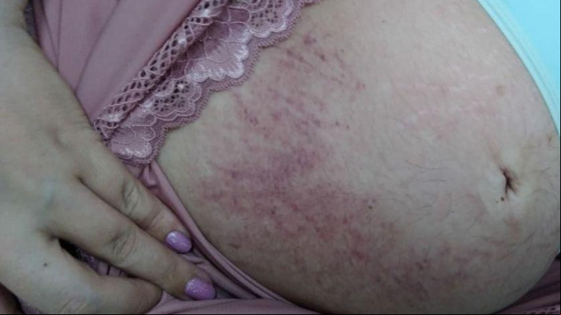 Mãe deuncia violência obstétrica no Hospital Maternidade de Baturité