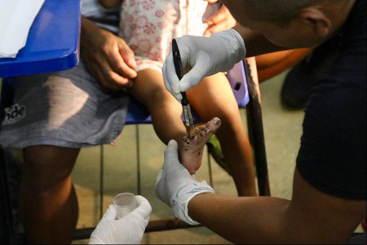 Infecção é propícia em terrenos arenosos, principalmente em áreas de criação de animais, muito comum em sítios e regiões interioranas