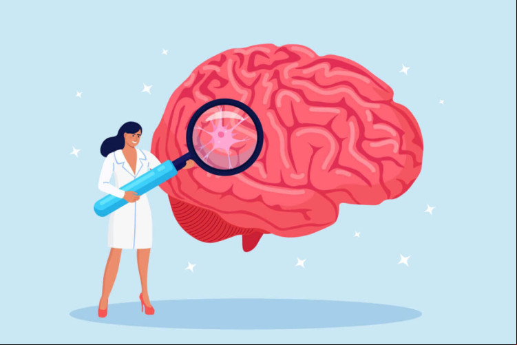 A hemorragia cerebral é uma condição grave que merece atenção (Imagem: Buravleva stock | Shutterstock)