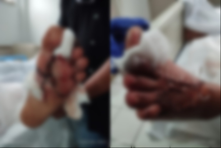 Policial fere o pé após pisar em bomba caseira durante treinamento da corporação.