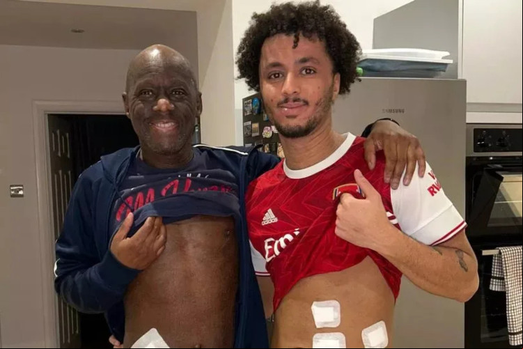 Joshua Andrew, de 23 anos, doou um rim a David Andrew, de 57 anos Joshua Andrew, de 23 anos, doou um rim a David Andrew, de 57 anos