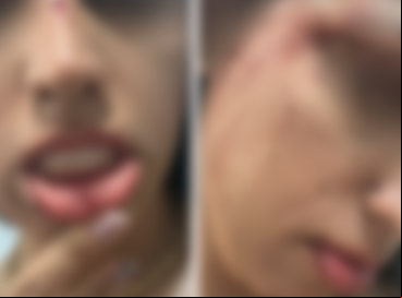 Dentista denuncia agressão sofrida por ex-namorado policial, no Ceará 