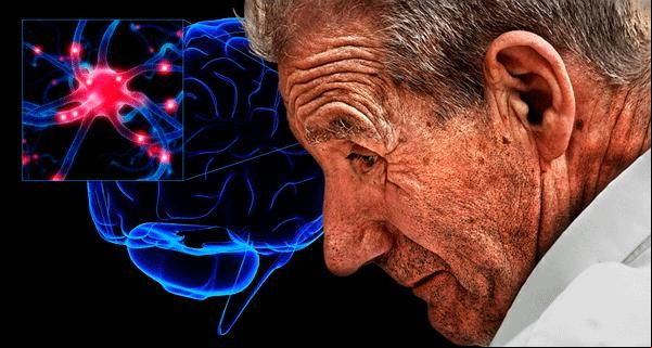Embora associada aos idosos, cerca de 10% a 20% dos casos de Parkinson ocorrem em adultos com menos de 50 anos 